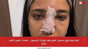 أزمة فيلر كنزي مدبولي تفتح ملف كوارث التجميل.. نجمات دفعن الثمن غالياً